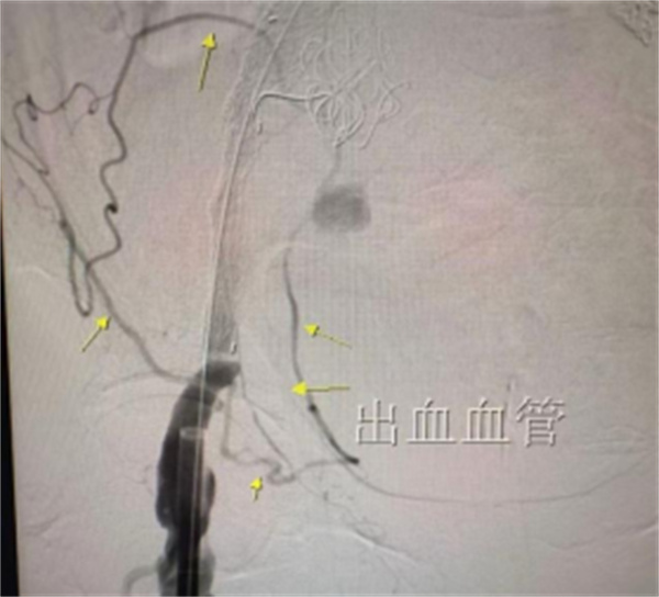 微信图片_2026-02-14_152326_000.jpg 微信图片_2026-02-14_152326_000.jpg